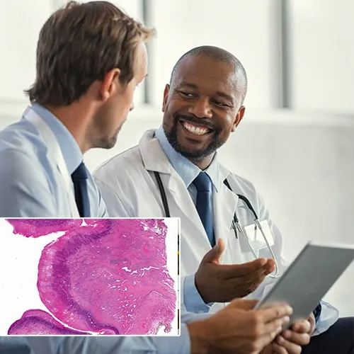 Why Choose  Urological Consultants of Florida 
for Your Penile Implant?