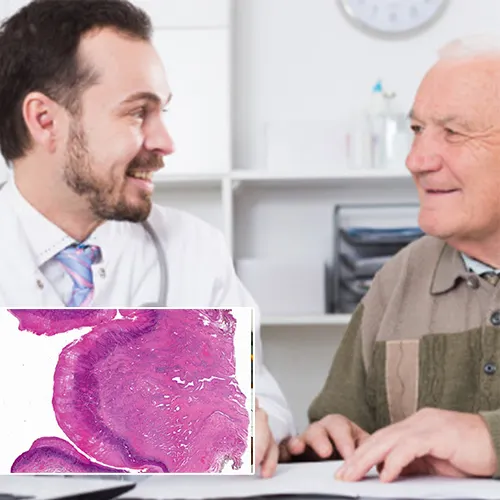 Explore the Benefits of Modern Penile Implants with  Urological Consultants of Florida 
